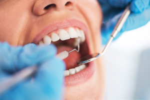 Tips To Choose The Best Dentist For Dental Implants
