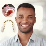 Tips To Choose Between Lingual Braces And Other Invisible Options